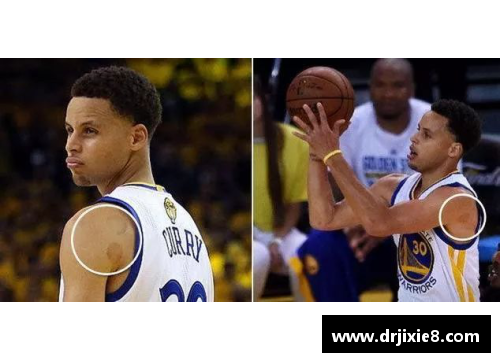EBET易博官方网站NBA球员拔火罐：健康潮流还是趋势风险？